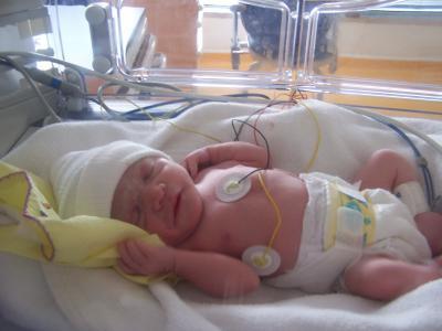 Πνευμονία σε νεογέννητο: μια τρομερή και επικίνδυνη ασθένεια
