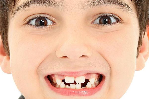 Οδοντοφυΐας και ανάπτυξη των δοντιών στα παιδιά: τραπέζι. Όλα σχετικά με την έκρηξη των βρεφικών δοντιών στα βρέφη